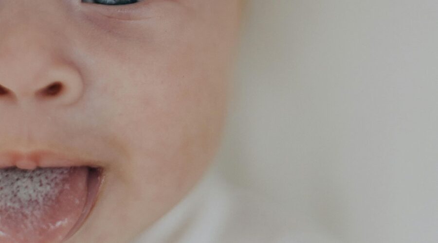 Mengatasi lidah putih pada bayi